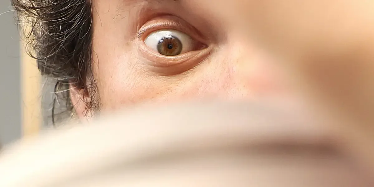 Layoffs at Sam Altman's eye-scanning startup raise concerns about industry viability